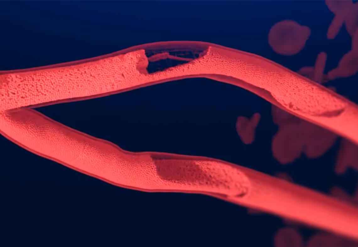 Blood cells within a vessel