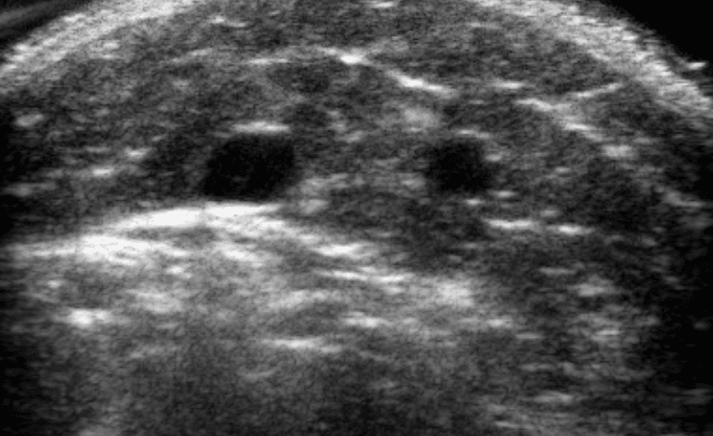 Robotic tomographic ultrasound imaging